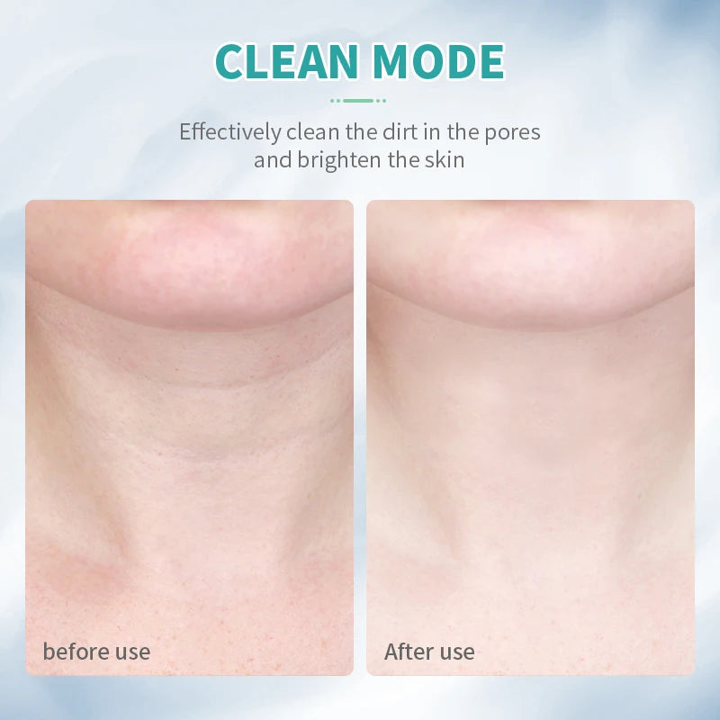 ANLAN Neck & Face Beauty Device | EMS Facial & Neck Lifting with 3-Color Light Therapy for Skin Tightening & Double Chin Reduction