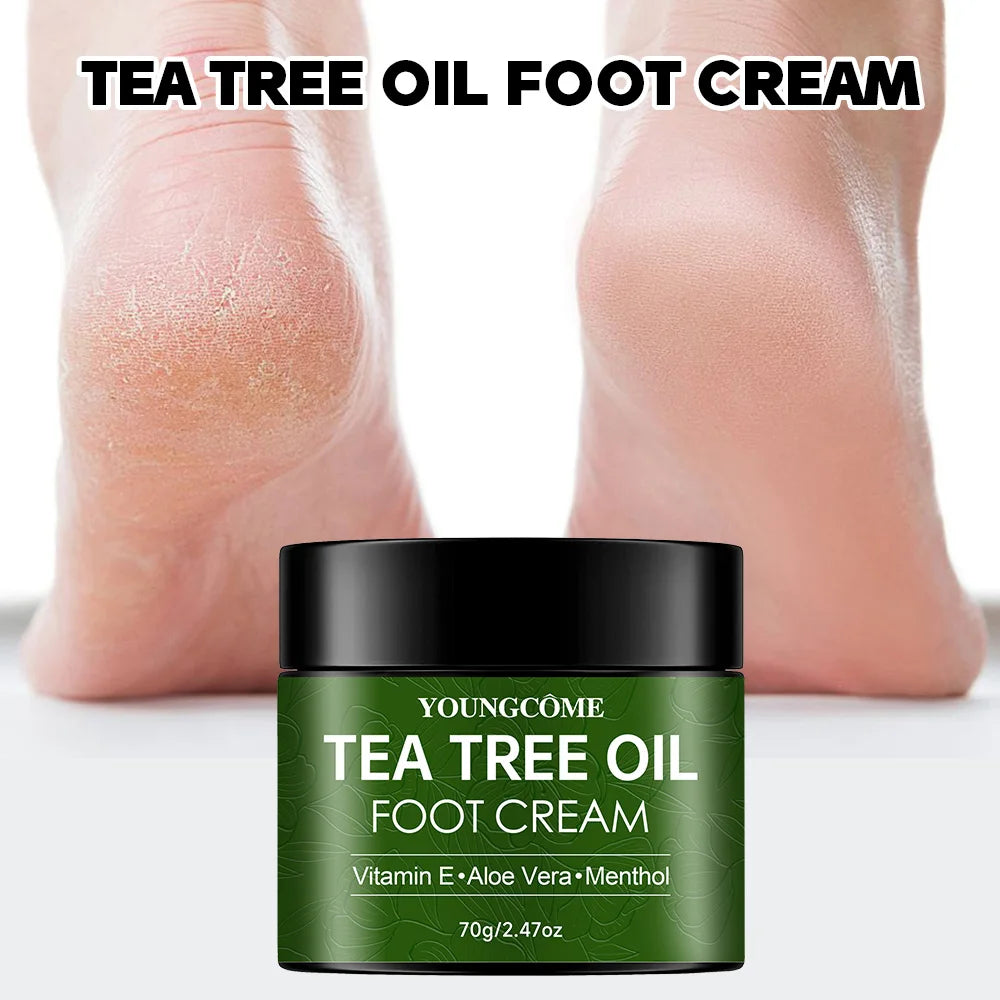 YOUNGCOME Tea Tree Foot Cream – 40g/70g Heel Repair & Moisturizing Treatment with Aloe Vera, Menthol & Vitamin E