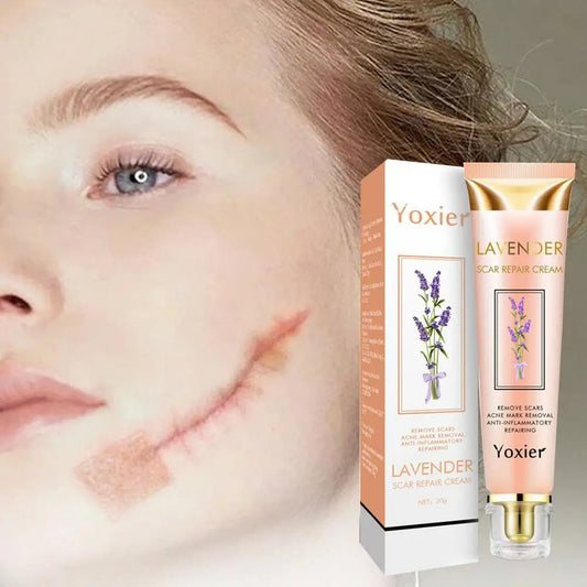 5X Yoxier Lavender Scar Repair Cream Acne Scar Removal Remove Pigmentation Scar Marks Stretch Smooth Skin Care Whitening Cream