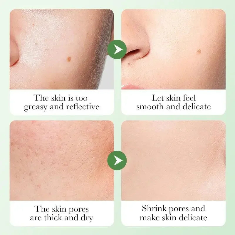 BIOAQUA Centella Skin Care Set – 6pcs | Moisturizing, Anti-Wrinkle & Barrier Repair