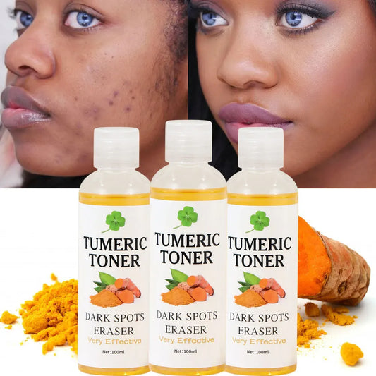 Turmeric Toner | Dark Spot Eraser | Brightening, Clarifying & Visible Results