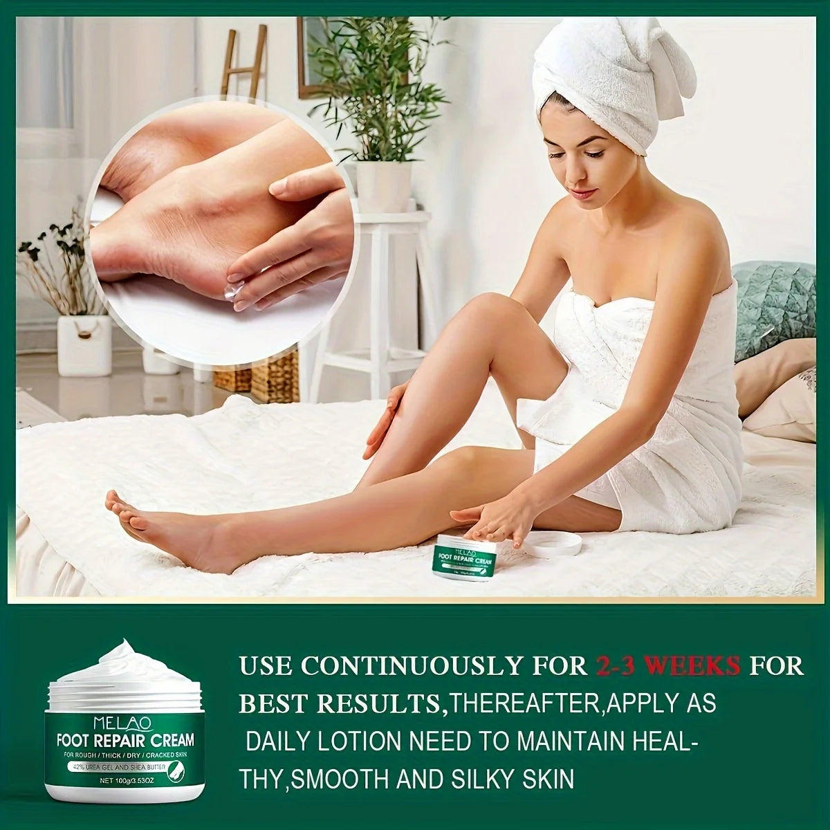 MELAO Urea Foot Cream – 100g Repair & Moisturizing Treatment for Dry, Cracked Feet, Heels & Hands