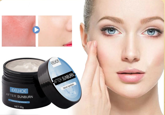 EELHOE After Sun Repair Cream – 50g Aloe Vera Gel for Sunburn Relief, Skin Moisturizing & Recovery for Face & Body