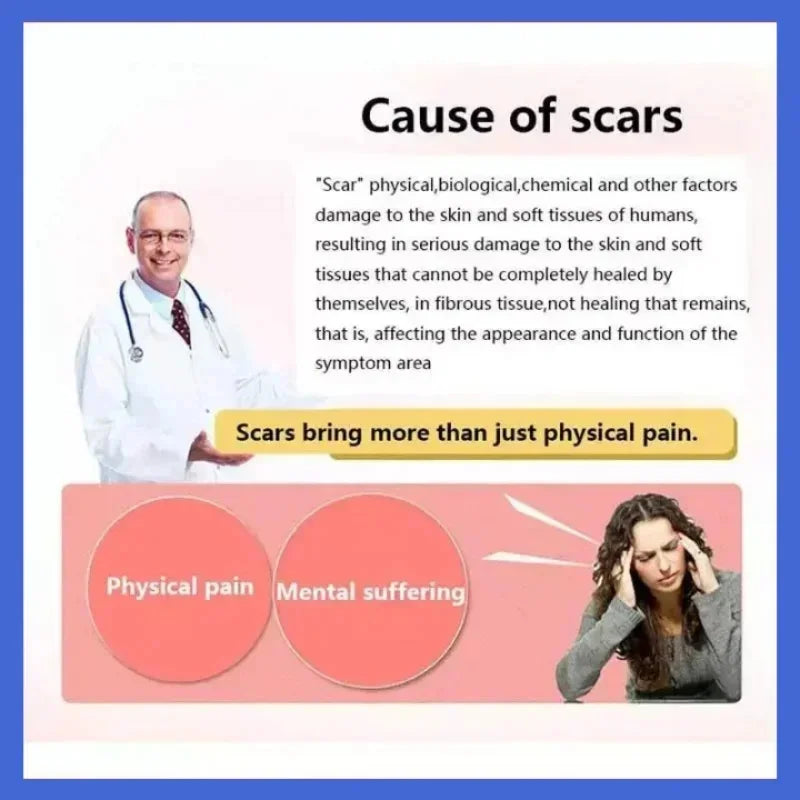 Scar Removal Cream Gel Remove Acne Spots Treatment Stretch Marks Burn Surgical Scar Repair Cream Smoothing Whitening Skin Beauty