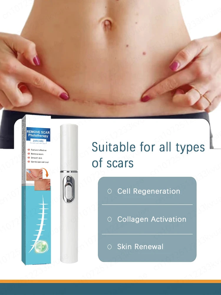 Magic scar removal tool, removes scars, burns, stretch marks, acne marks and other scars