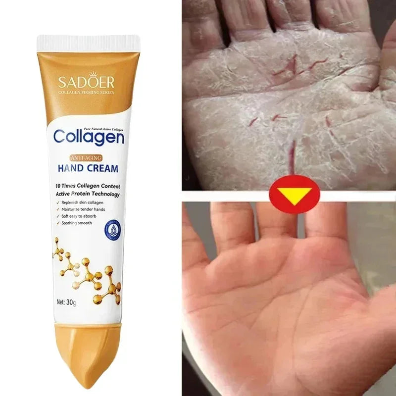 SADOER Collagen Hand Cream – 30g Anti-Wrinkle & Whitening Moisturizer for Dry, Cracked Hands
