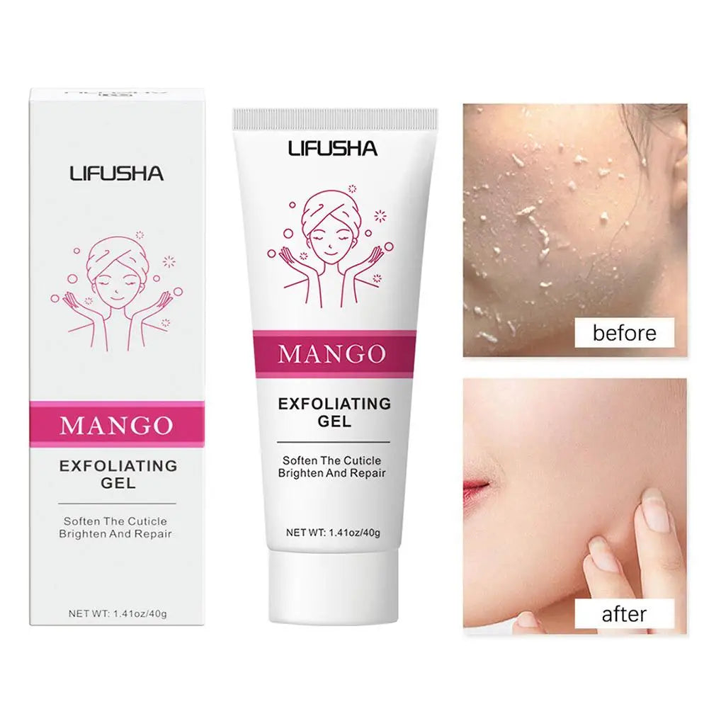 Aloe Vera Facial Exfoliating Gel – 30g–100g Deep Cleansing Scrub for Blackhead Removal & Pore Tightening