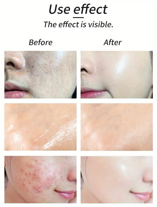 GZE 99% Aloe Soothing Gel – 30g Premium Aloe Vera Gel for Face & Dry Skin, Sunburn Relief & Moisturizing Care