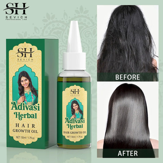 SEVICH Adivasi Herbal Hair Growth Oil – 50ml Ayurvedic Serum for Regrowth & Scalp Nourishment