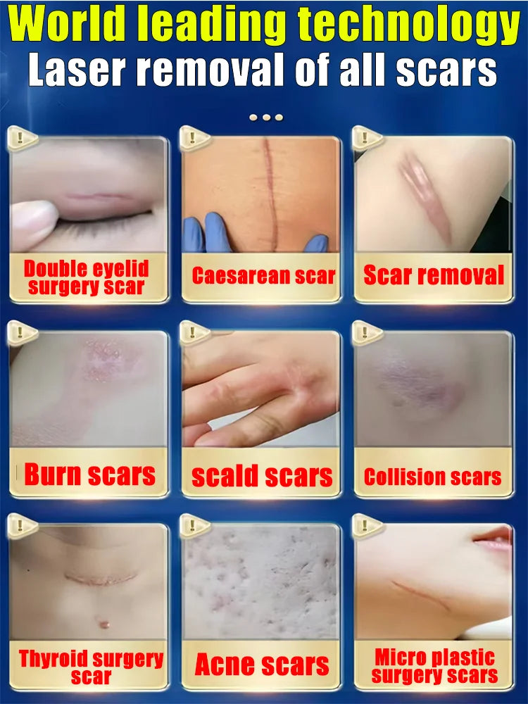 Magic scar removal tool, removes scars, burns, stretch marks, acne marks and other scars