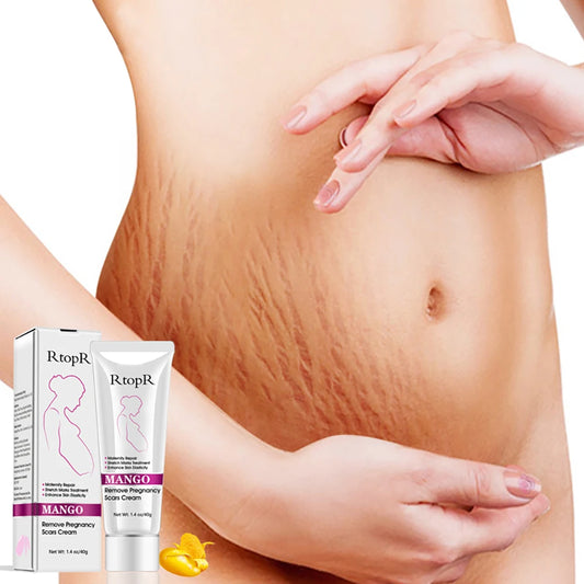 RtopR Remove Pregnancy Scars Acne Cream Stretch Marks Treatment Maternity Repair Anti-Aging Anti Winkles Firming Body Creams