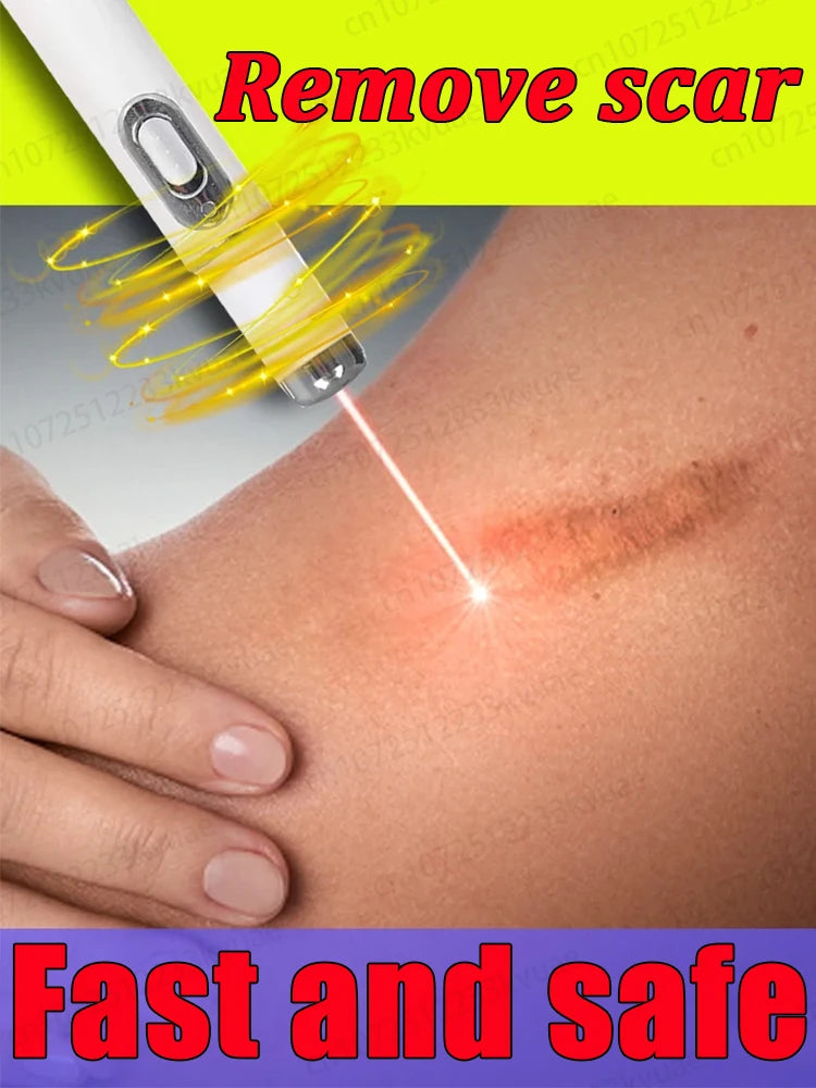 Magic scar removal tool, removes scars, burns, stretch marks, acne marks and other scars
