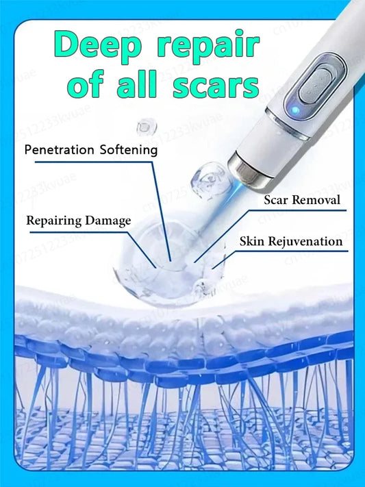 Magic scar removal tool, removes scars, burns, stretch marks, acne marks and other scars