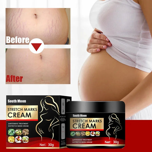 Effective Remove Pregnancy Scars Acne Cream Stretch Mark Treatment Maternity Repair Anti-Aging Anti-Winkle Firming Body Cream