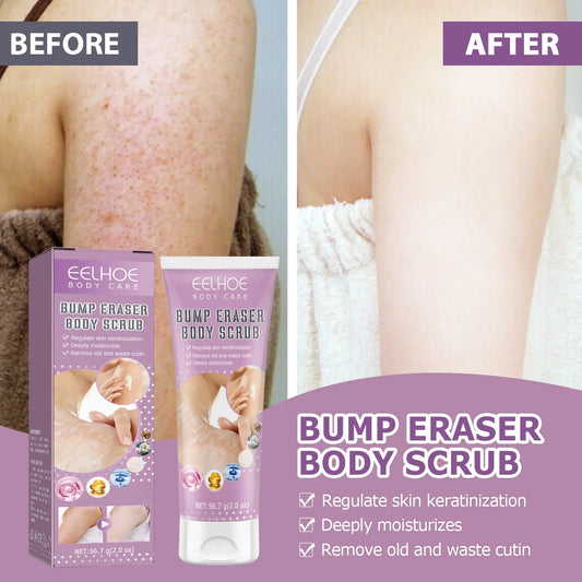 Body Scrub, Suitable For Hair Keratosis Rough Body Scrub Smooth And Comfortable