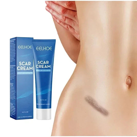 15g Scar Removing Cream Stretch Mark Removal Gel Face Body Acne Marks Injury Cesarean Burn Abrasions Scars Skin Repair Cream