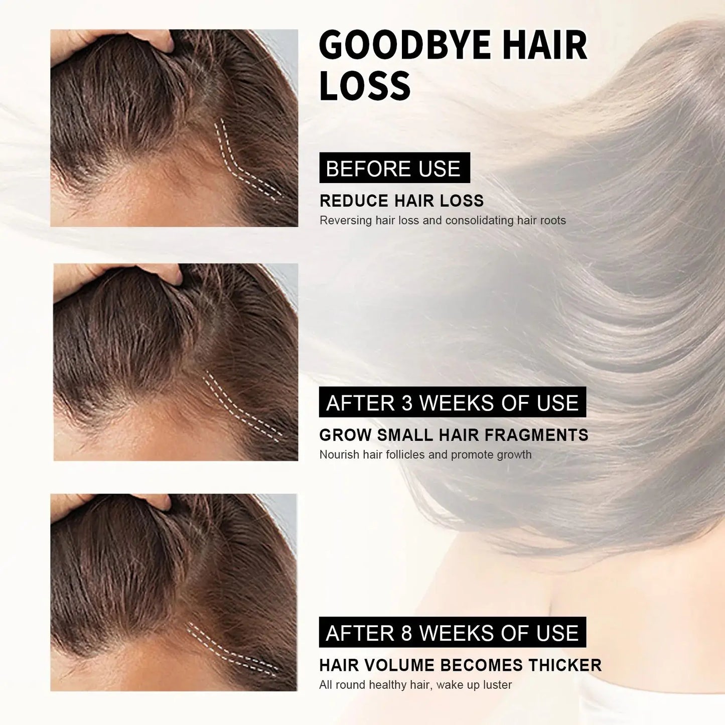 Hair Growth Shampoo Anti Hair Loss Anti-dandruff Repair Damaged Scalp Follicles Fast Baldness Treatment Hair Regrowth Care 60ml