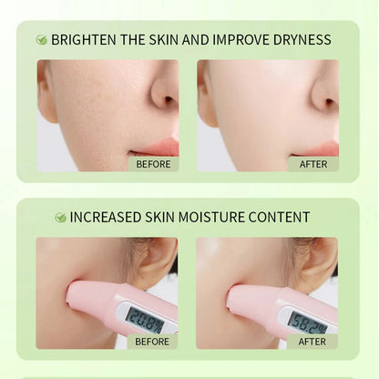 Panthenol 5% & Green Tea Calming Korean Serum | Soothing, Moisturizing, Acne Care | 30ml