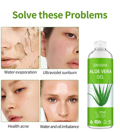 Envisha | 99.75% Organic Aloe Vera gel | Soothing, Moisturizing & Sunburn Repair