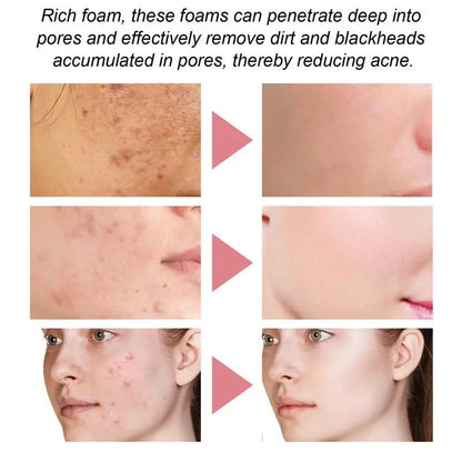 Professional Facial Mousse | Vitamin C, Hyaluronic Acid & Niacinamide | Deep Cleansing & Anti-Aging