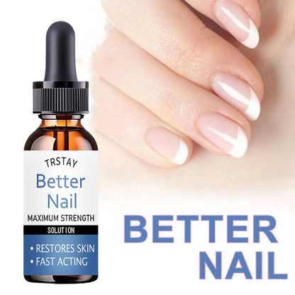5ML/15ML/30ML/50ML/Repair nail fungus foot mask repair toenail essence liquid