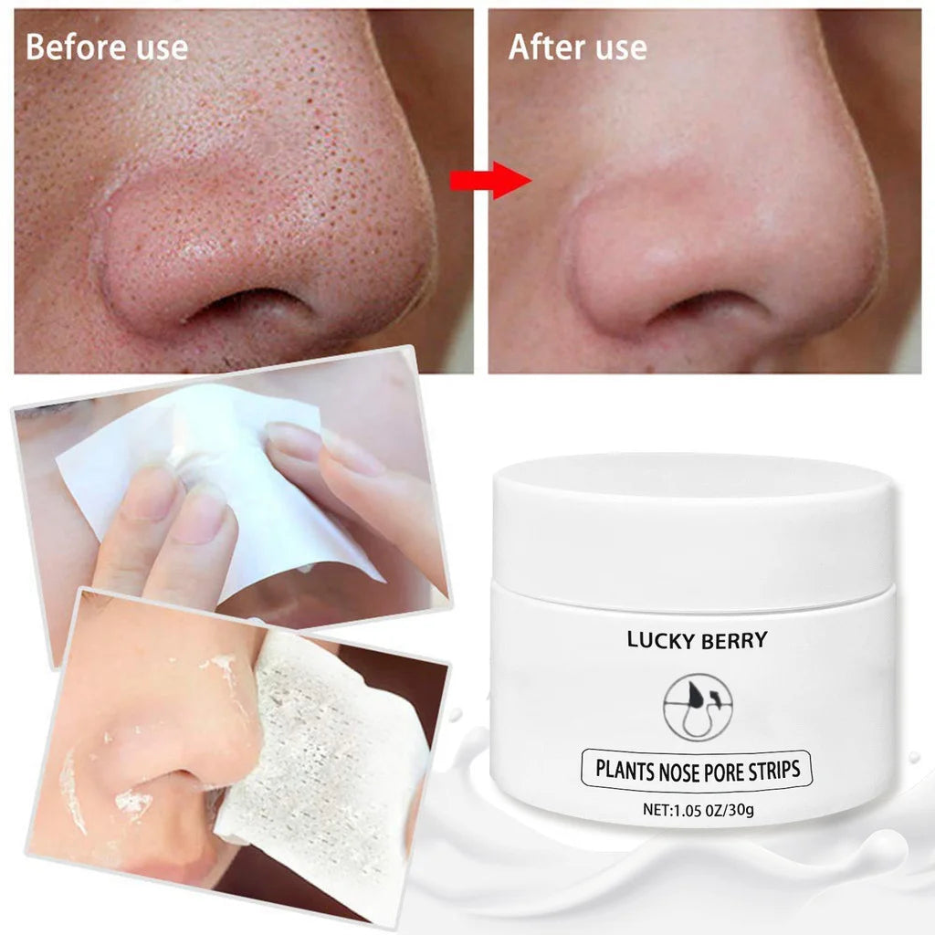 LUCKY BERRY Milky Mud Nose Pore Strips | Deep Cleansing for Acne & Blackhead Removal | Lightweight, Non-Greasy Formula | 30g