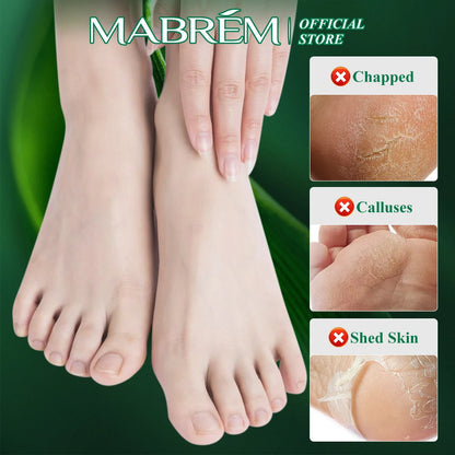 MABREM Foot Treatment Cream Whitening Anti-cracking Moisturizing  Protection Cream Relive Pain Foot Cream Exfoliating Scrub 40g