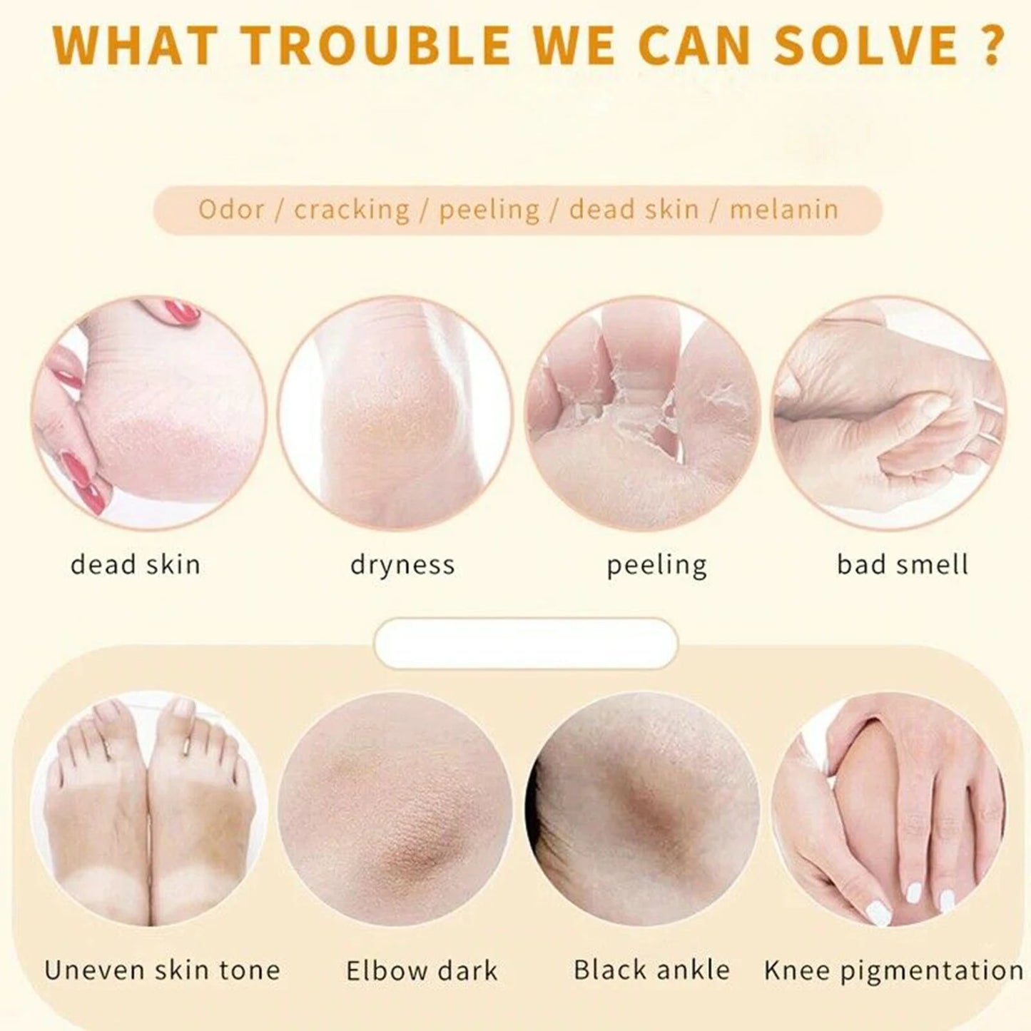 100ML Foot Peeling Spray Nourish Moisturizing Elbow Exfoliating Essence Dead Skin Remover Pedicure Foot Care Tool