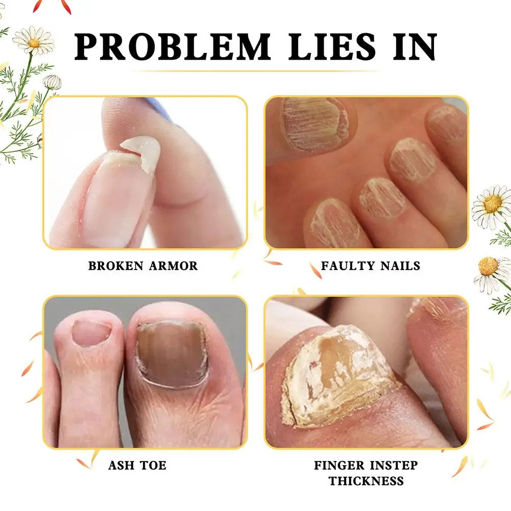 Intense Nail Growth And Strengthening Serum 7 Days Nail Growth And Strengthening Serum Nail Strengthener For Thin Nails And T5h9