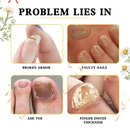 Intense Nail Growth And Strengthening Serum 7 Days Nail Growth And Strengthening Serum Nail Strengthener For Thin Nails And T5h9