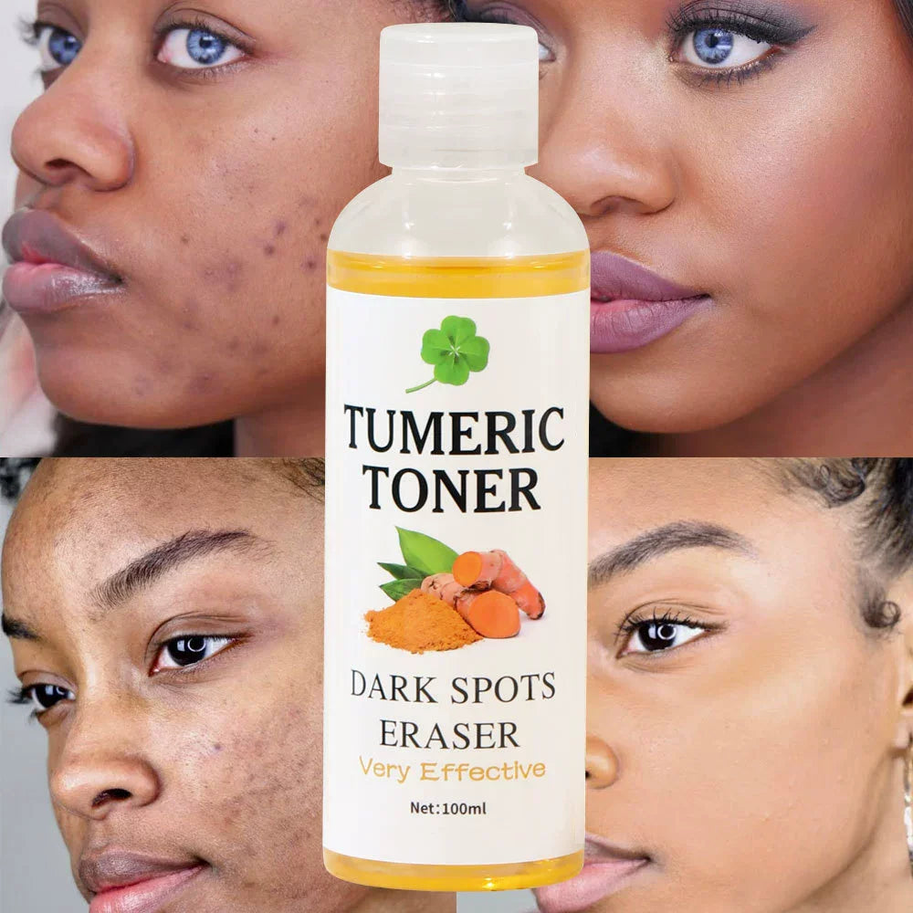 Turmeric Toner | Dark Spot Eraser | Brightening, Clarifying & Visible Results
