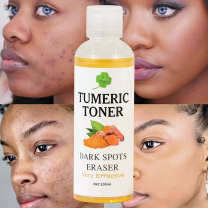 Turmeric Toner | Dark Spot Eraser | Brightening, Clarifying & Visible Results