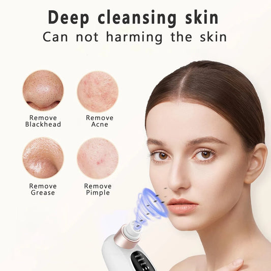 Electric Vacuum Water Cycle | Rechargeable Blackhead & Pore Remover