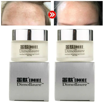 Dimollaure Face Whitening Cream Removal Freckle Melasma Pigment Melanin Sunburn Pregnancy Spots Acne Dark Spots Skin Care