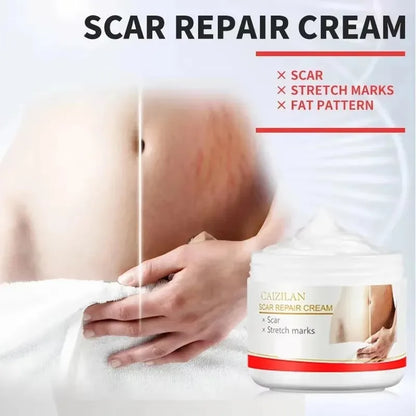 Stretch Marks Permanent Removal Cream Eliminate Body Belly Stretch Marks Swelling Marks Remove Skin Cracks Repair Firming Care