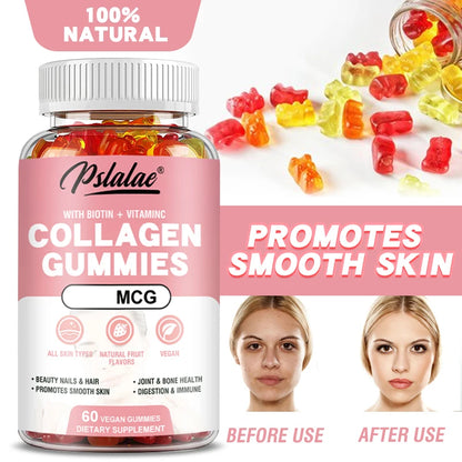 Pslalae | Collagen Gummies with Vitamin C & Biotin | Hair, Nails, Smooth Skin, Joint & Bone Health | 60 Vegan Gummies