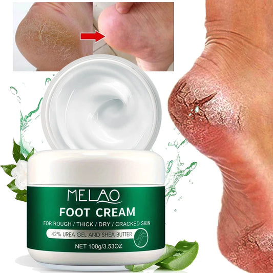 MELAO Urea Foot Cream – 100g Repair & Moisturizing Treatment for Dry, Cracked Feet, Heels & Hands
