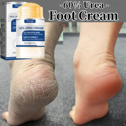 60% Urea Foot Cream Aloe Vera Ultra-hydrating Softening Dry Cracked Feet Cream Gentle Exfoliation Daily Foot Care Solution 40g