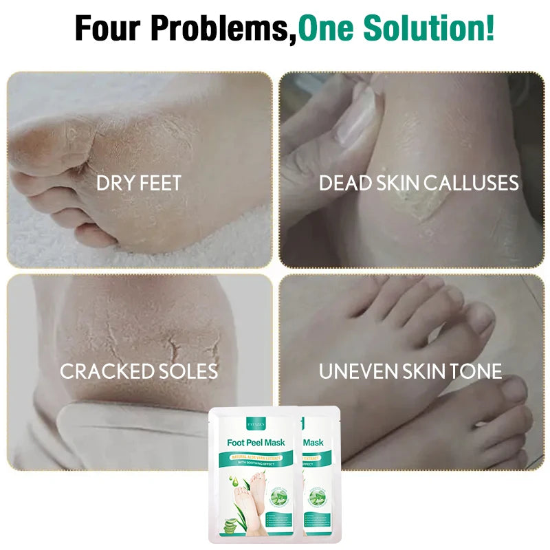 Aloe Foot Peel Mask For Dry Rough Cracked Feet,Brightening Your Feet,Soothing Your Feet&Heel,Make Your Feet Smooth And Soft