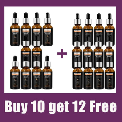 High Repurchase,Hair Growth Oil,Biotin DHT Blocker,Anti-Loss Shampoo,Boost Regrowth,Increase Production of Shampoo,hair Growth