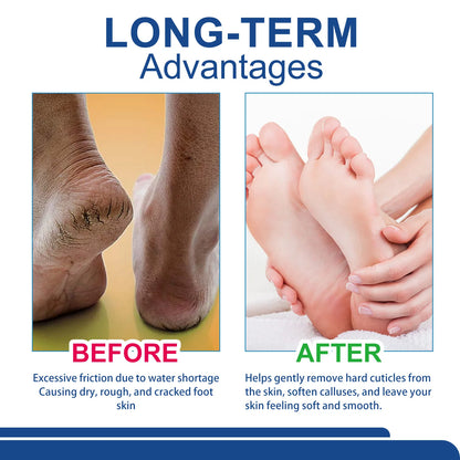 60% Urea Foot Cream Aloe Vera Ultra-hydrating Softening Dry Cracked Feet Cream Gentle Exfoliation Daily Foot Care Solution 40g