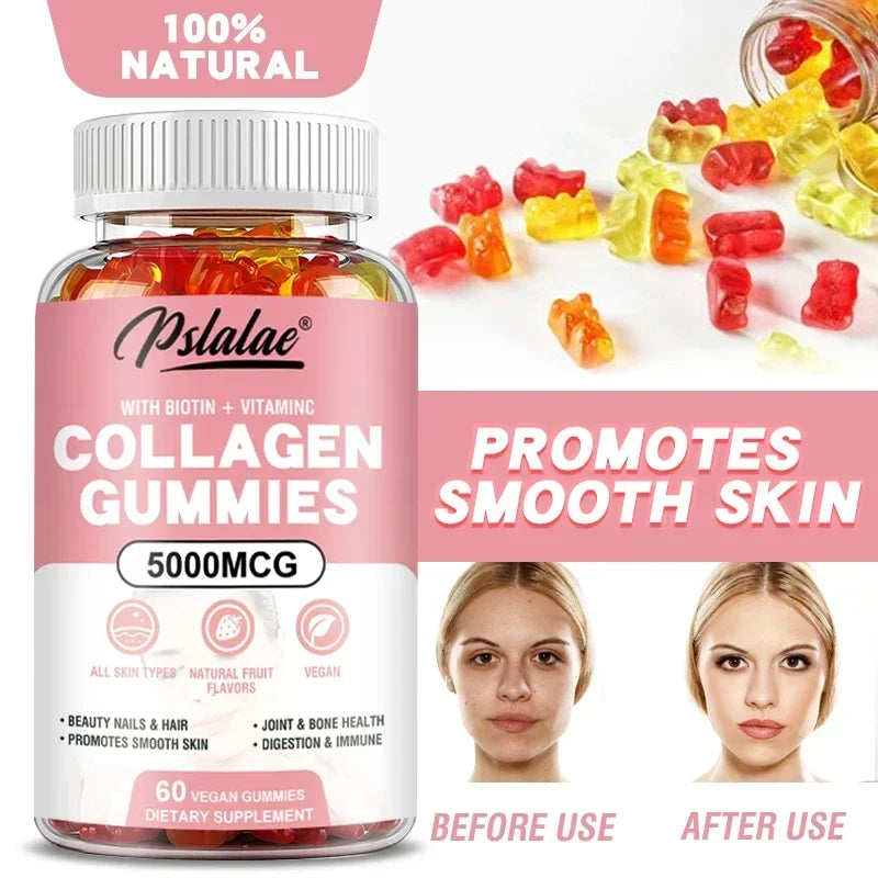 Pslalae | Collagen Gummies with Biotin & Vitamin C | Hair, Skin, Nails, Joint & Immune Support | 60 Vegan Gummies