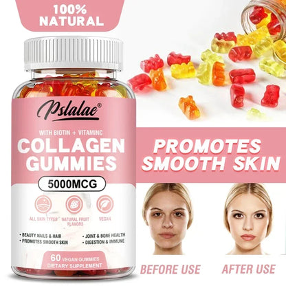 Pslalae | Collagen Gummies with Biotin & Vitamin C | Hair, Skin, Nails, Joint & Immune Support | 60 Vegan Gummies