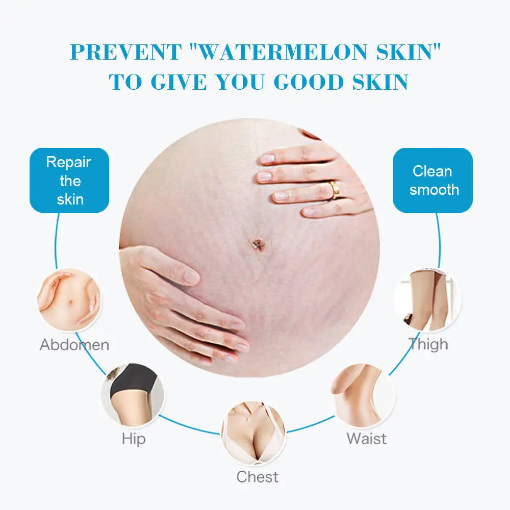Anti Stretch Mark Cream Repair And Fade Fine Lines, Postpartum Fat Line Repair Cream