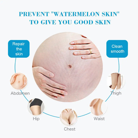 Anti Stretch Mark Cream Repair And Fade Fine Lines, Postpartum Fat Line Repair Cream