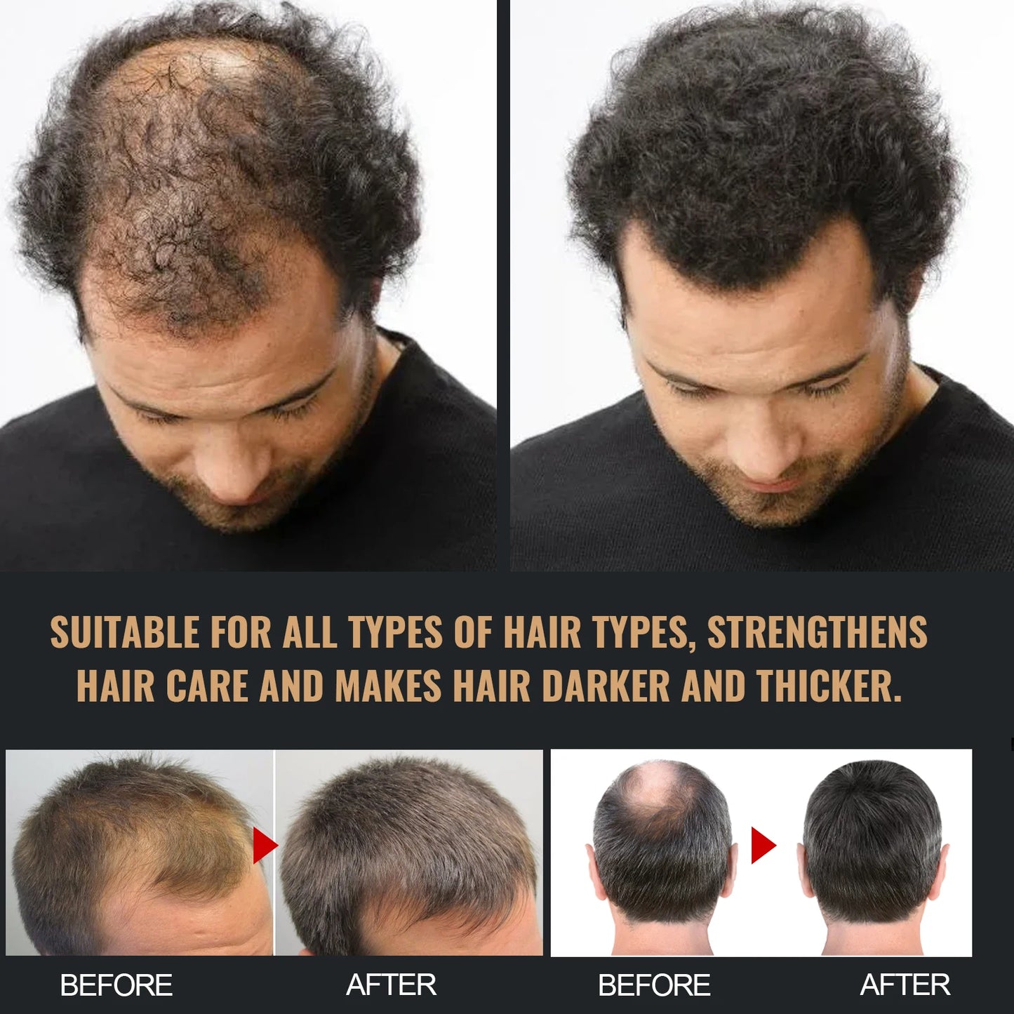 Shampoo Gently Clean Hair Remove Dandruff Control Oil Reduce Hair Loss Stabilize Hair Roots Nourish Smooth Hair Fluffy Shampoo