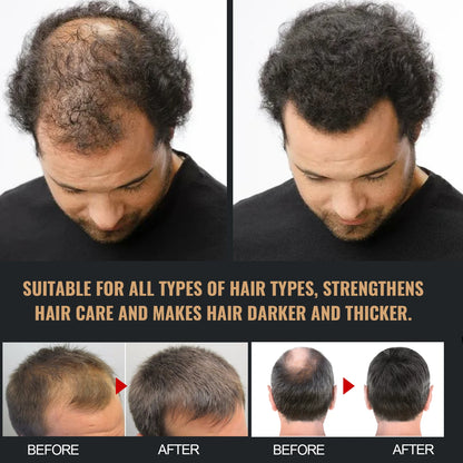 Shampoo Gently Clean Hair Remove Dandruff Control Oil Reduce Hair Loss Stabilize Hair Roots Nourish Smooth Hair Fluffy Shampoo