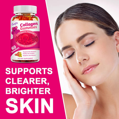 Catfit | Collagen Gummies with Biotin | Skin Brightening, Hair & Nail Health, Joint Support | 60 Gummies