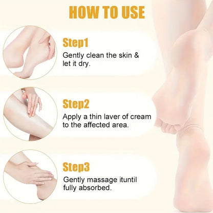 Urea 40% Cream Foot Cream for Dry Cracked Feet Heels Knees Hands Repair Treatment,Moisturizer Dead Skin Remover Foot Cream