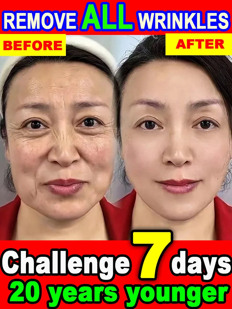 POZOAMIS | Glyceryl Glucoside Hyaluronic Acid | Anti Aging Serum